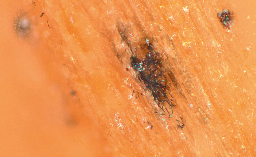 Abbildung 2b: Verminderte Schichtdicke begünstigt Pilzwachstum