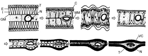 Bild 20: Entwicklung eines Insektenflügels. E Epidermiszellen mit I Interzellularen, GM Grundmembran, T Trachee, N Nerv, C Cuticula, MM Mittellamelle, VC Verhärtete Cuticula. - © Bild 20 nach Weber (1949)
