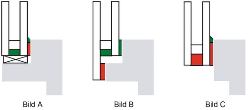 Bild 3: Konstruktionsvarianten