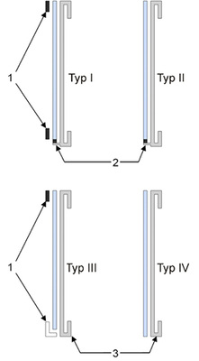 <p>
Rechts: geklebte Glaskonstruktionenbei SG-Fassaden 1 Haltevorrichtung zur Gefahrenverringerung bei Versagen der Verklebung
</p>

<p>
2 Mechanische Abtragung des Eigengewichtes
</p>

<p>
3 Glashalterahmen
</p>