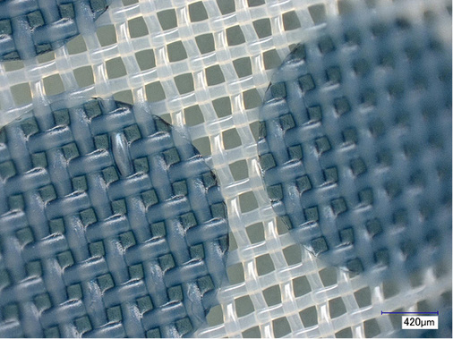 
Azocol S 385 Conduct: 100-fach vergrößert. Gewebe: PET 1500 77-55, Beschichtung 2-2, Schichtaufbau 15 µm, Belichtung 150 s bei 3000 W.



