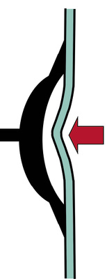 <p>
Schematische Darstellung der Glasbelastung unter starker punktueller Saugwirkung, durch den Sauger eines Hebegerätes
</p>

<p>
</p> - © Ekkehard Wagner

